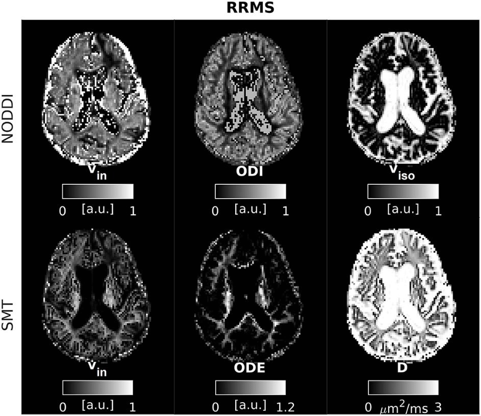 fig1